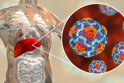 Tschechien warnt vor Hepatitis-A-Epidemie: Bereits 28 Todesfälle und Sicherheitsmaßnahmen an der Grenze zu Deutschland