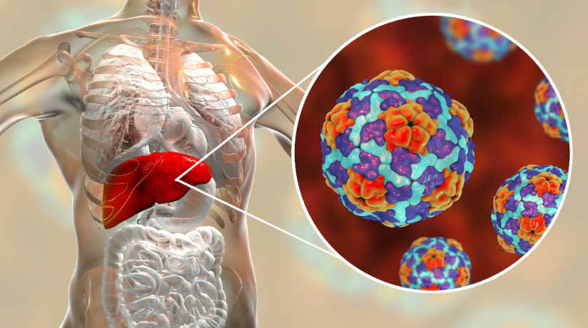 Tschechien warnt vor Hepatitis-A-Epidemie: Bereits 28 Todesfälle und Sicherheitsmaßnahmen an der Grenze zu Deutschland